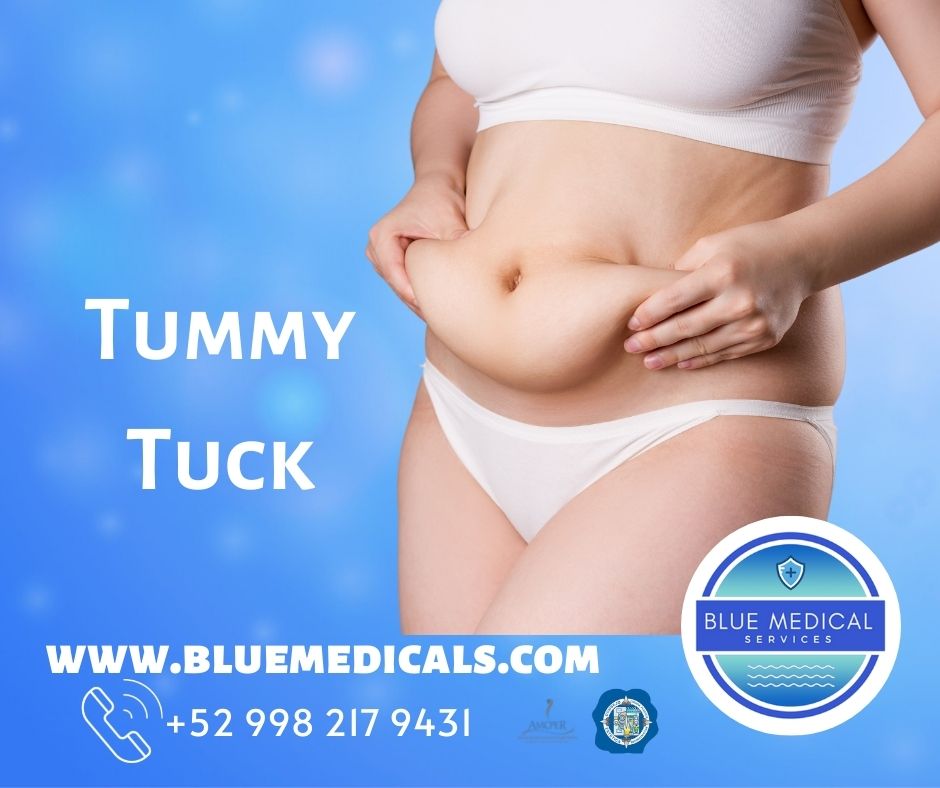 best surgeon for tummy tuck in cancun