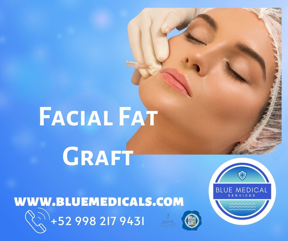facial fat graft in cancun