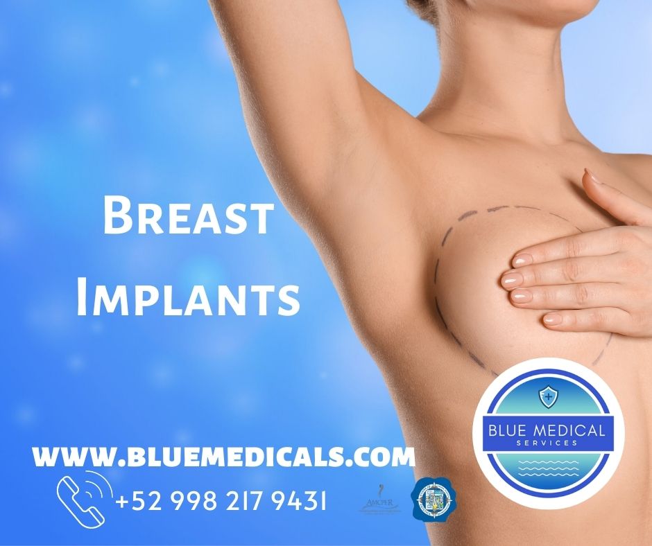 breast augmentation with implants in cancun