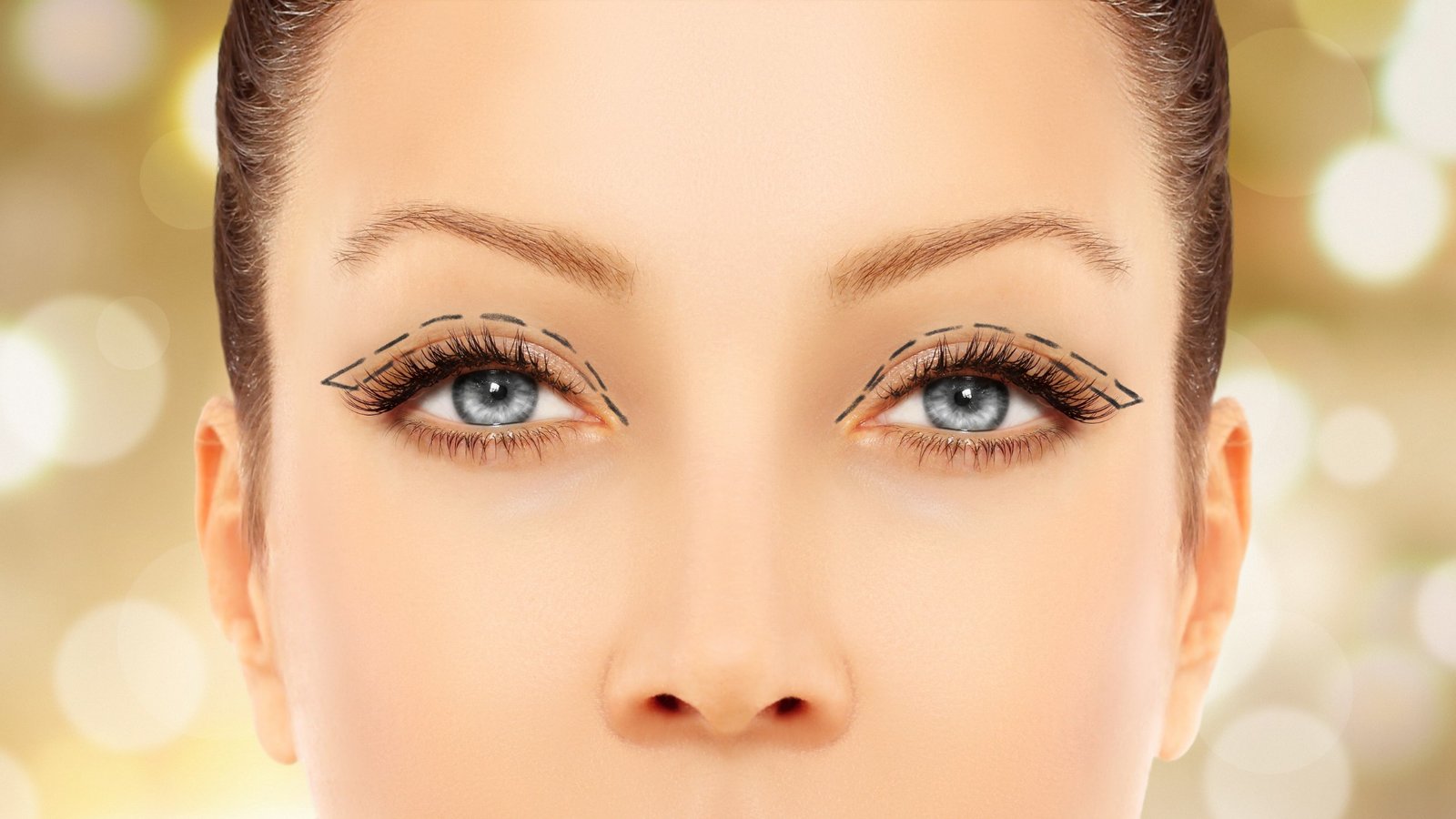 eyelid surgery in cancun