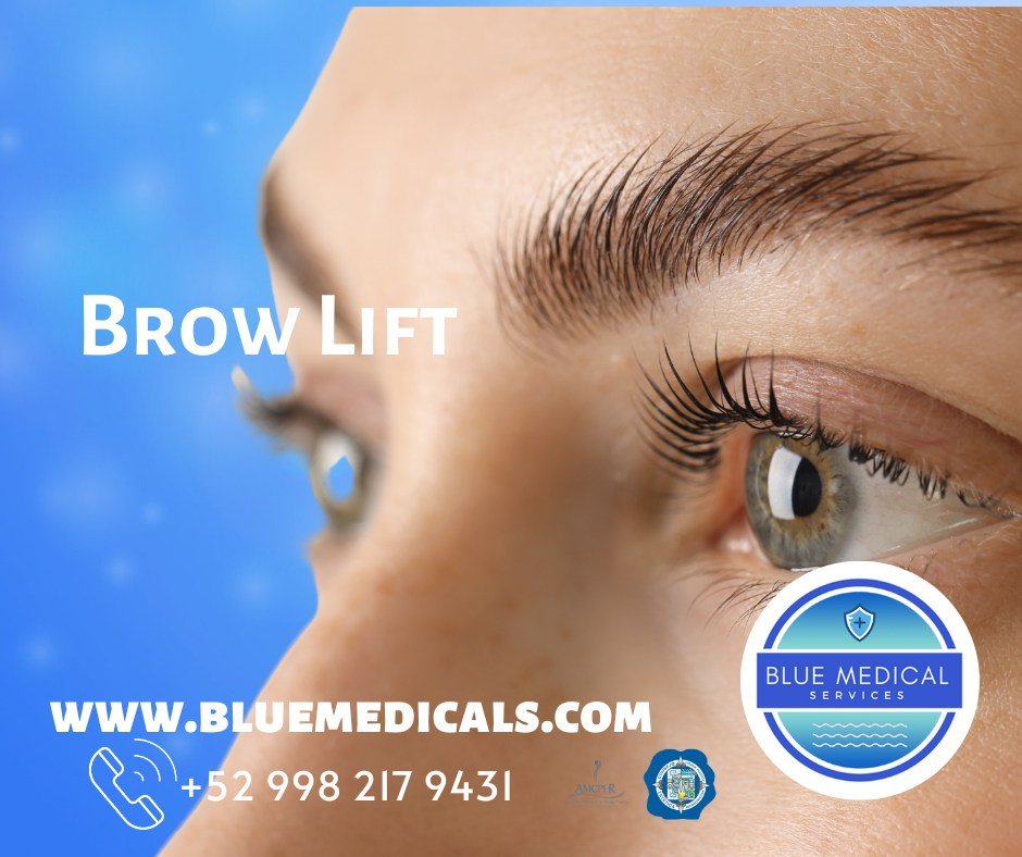 brow lift in cancun