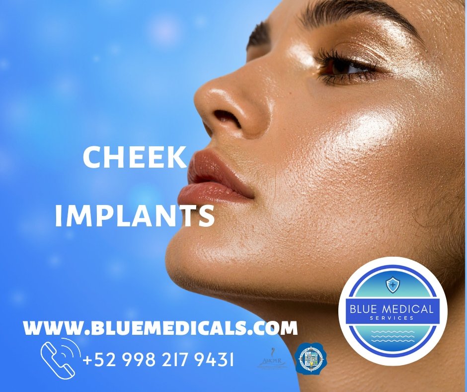 cheek implants cancun 1