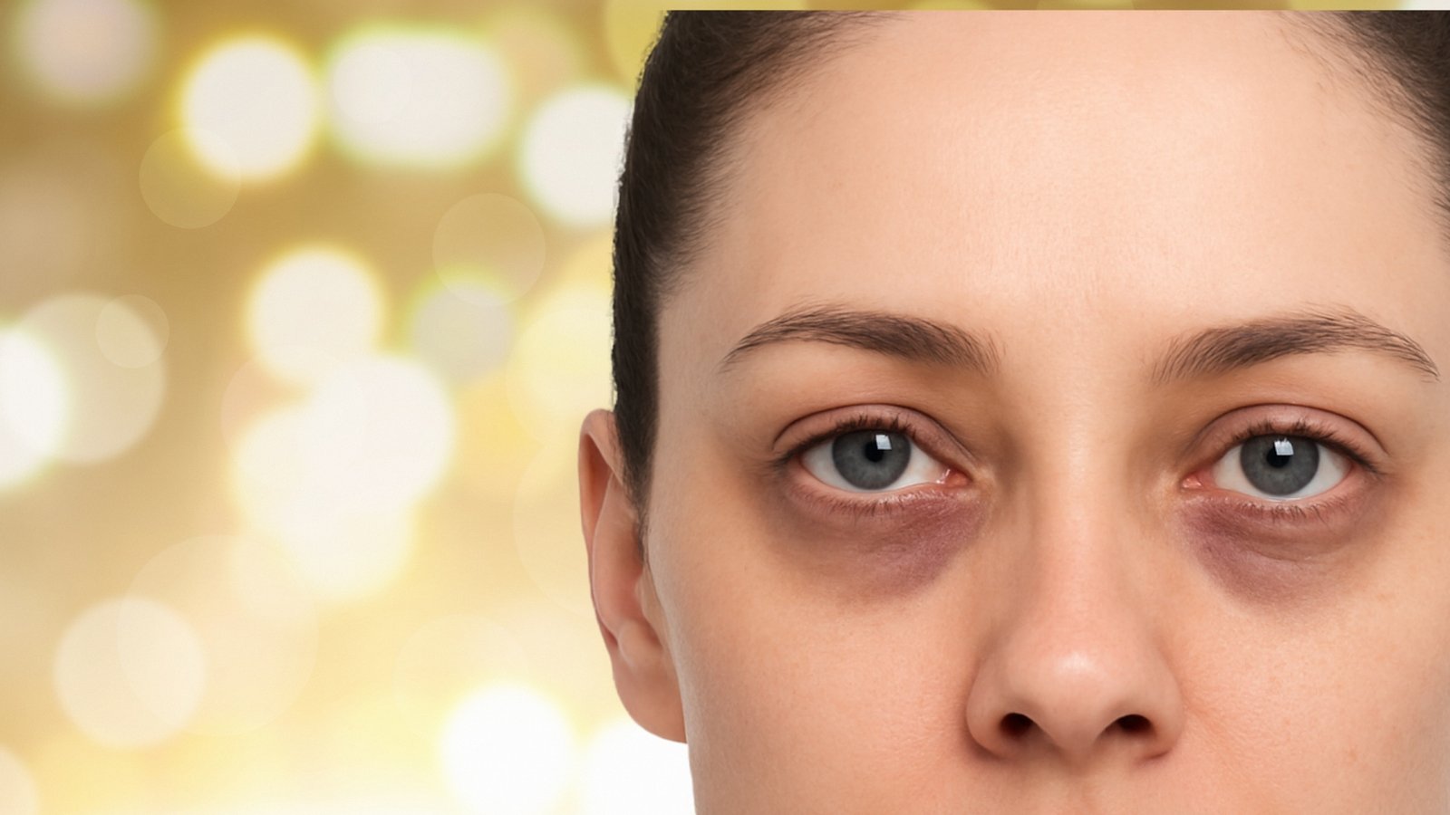 dark circle under the eye treatment in cancun blue medical