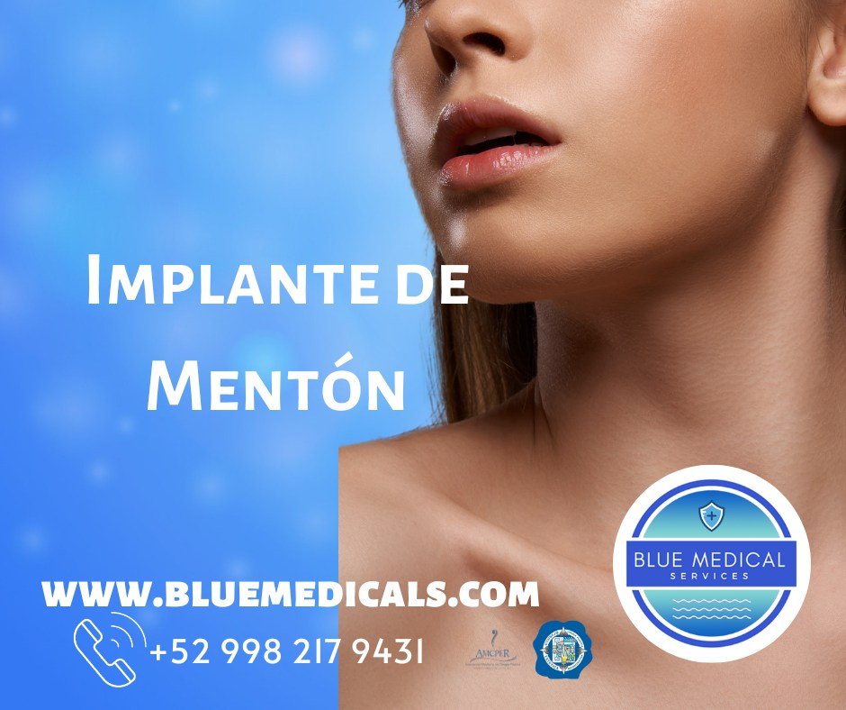 aumento de menton en cancun
