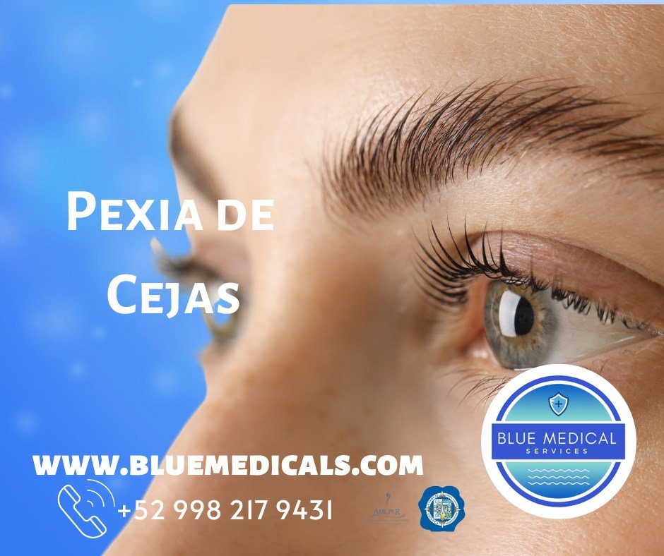 pexia de cejas en cancun